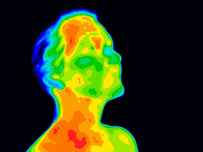 a thermography scan