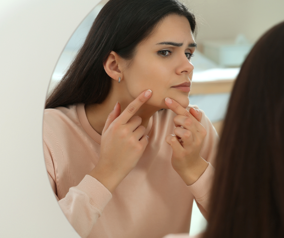 woman examines acne on face, one symptom of hormonal imbalance in women