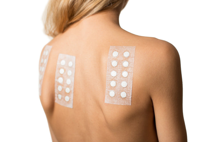 woman's back with RIPT patches
